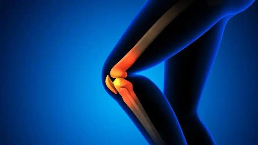  技术拆解：深蹲如何成为膝关节“慢性杀手”？二十年临床数据揭示残酷真相 健康养生